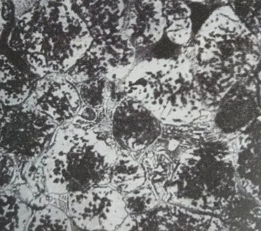 W18Cr4V嚴(yán)重過燒組織 W18Cr4V嚴(yán)重過燒組織